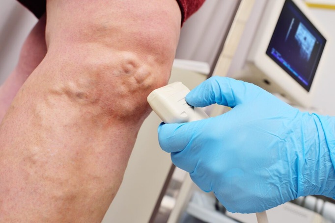Holistic Wellness Meets Modern Vein Treatment: A Balanced Approach to Vascular Health