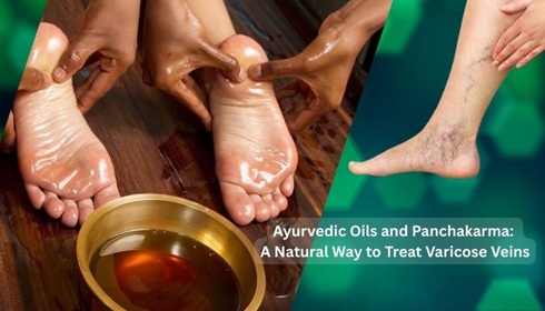 Holistic Wellness and Modern Varicose Vein Treatment: Finding the Right Balance