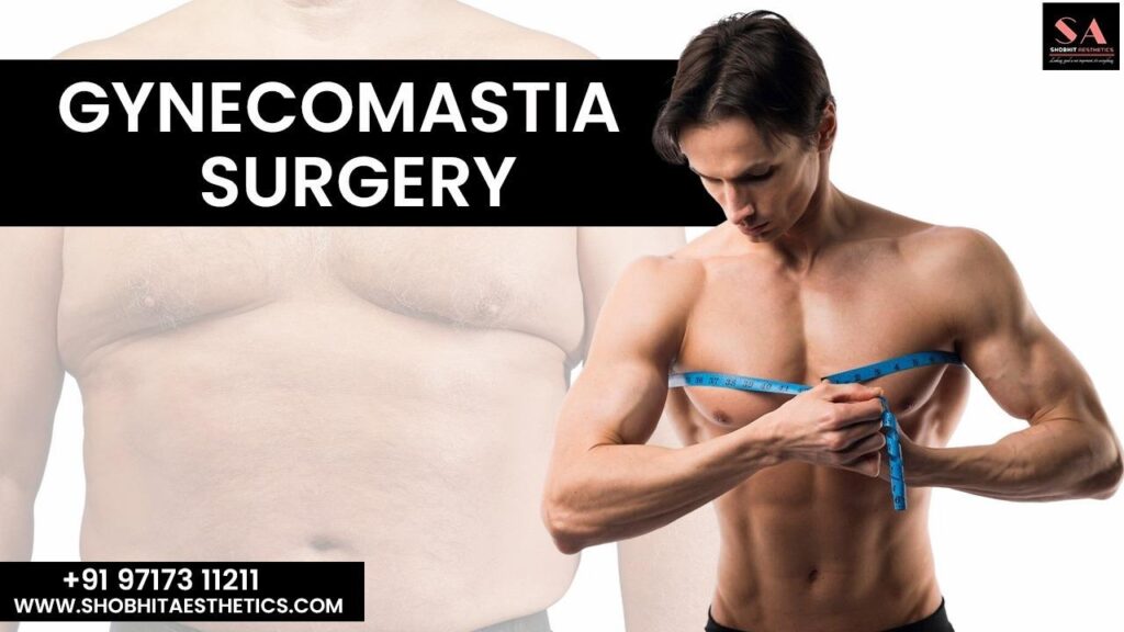 Gynecomastia Treatment in Delhi: The Right Age for Surgery