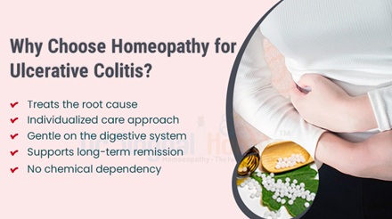 ulcerative colitis treatment in homeopathy